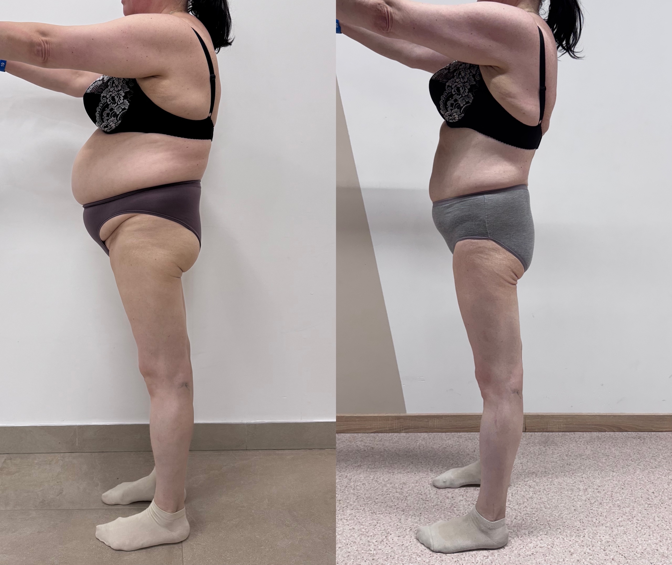 Результат участницы