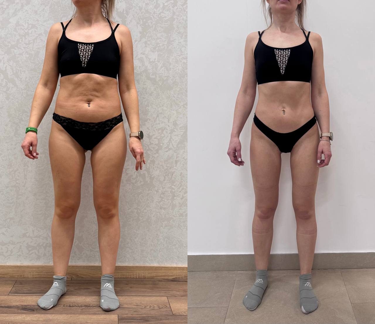 Результат участницы